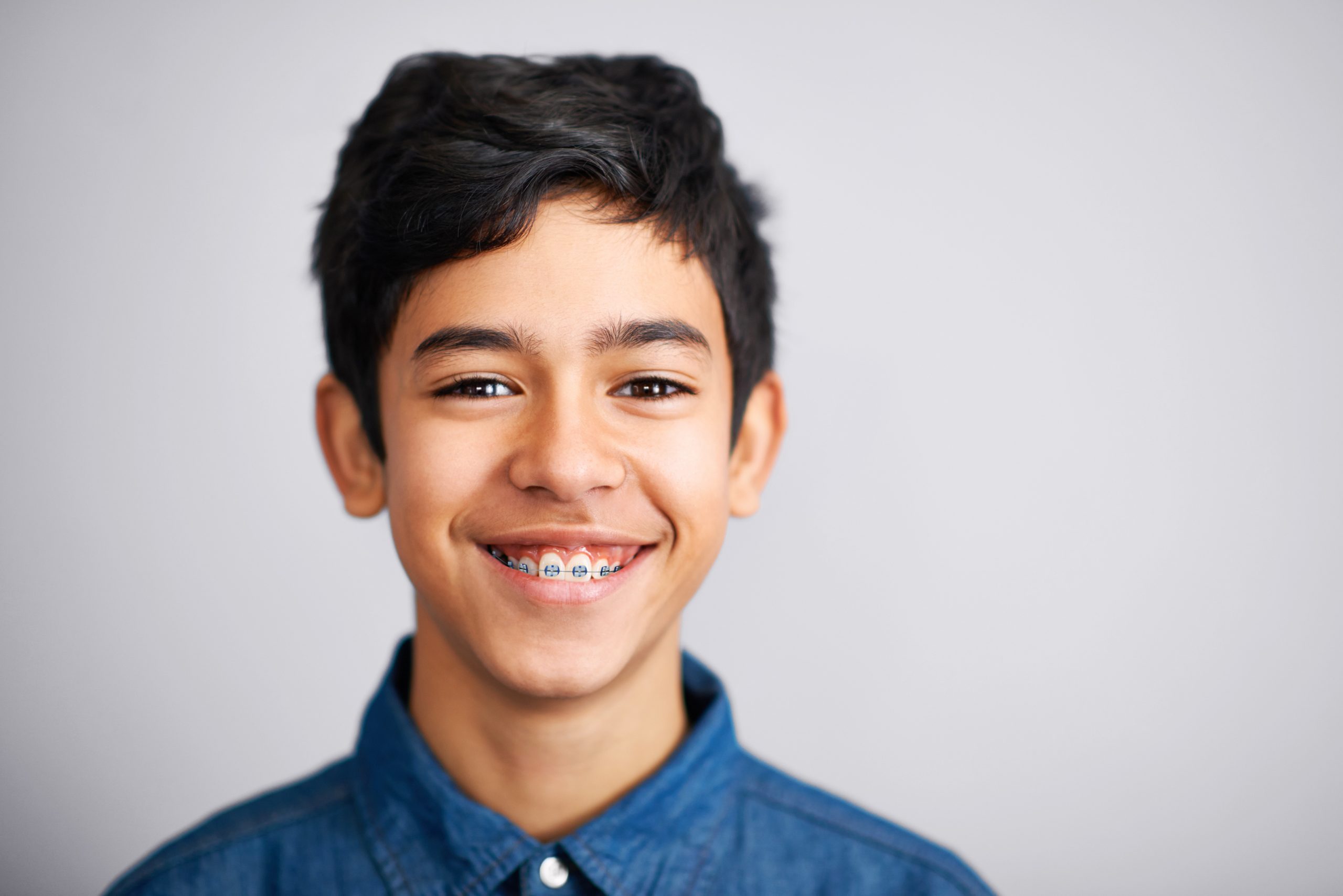 Orthodontic braces for Kids Glo Braces Truro